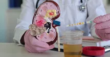 Stire din Sănătate : Examenul de urină. Când este recomandat și ce informații oferă