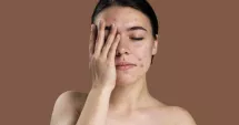 Stire din Sănătate : Cicatricile pielii. Ce le influențează și cum se estompează în timp