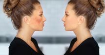 Stire din Sănătate : Melasma - secretul pentru un ten uniform și fără pete