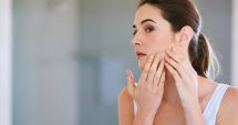 Stire din Sănătate : Persoanele cu vitiligo trebuie să fie atente la expunerea la soare