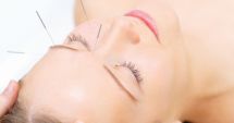Stire din Sănătate : Acupunctura, aliatul principal împotriva durerii