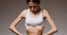 Stire din Sănătate : Fuga de mâncare! Atenţie la primele semne de anorexie, la adolescenți