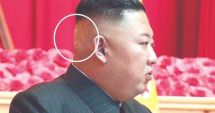 Bandajul de pe ceafa lui Kim Jong Un ridică multe semne de întrebare