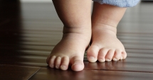Stire din Sănătate : Deformațiile piciorului la copii. "Lipsa tratamentului duce la invaliditate"