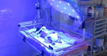 Stire din Sănătate : Fototerapia: soluția inovatoare în tratarea bolilor de piele