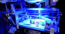 Stire din Sănătate : Cauzele icterului la nou-născuți. Cât de grave pot fi complicațiile