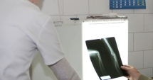 Stire din Sănătate : După ore de așteptare pe holul spitalului, trimisă acasă cu diagnostic greșit! "Se înnegrise, aveam fractură"