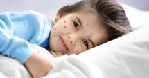Stire din Sănătate : Scarlatina provoacă inclusiv infecții în gât și pe piele