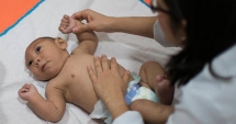 Stire din Sănătate : Virusul Zika, cât de periculos este  și ce simptome are. Copil din România, diagnosticat cu această boală