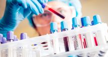 Stire din Actualitate : Oamenii de ştiinţă au descoperit o genă care poate creşte riscul de cancer al sângelui