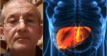 Stire din Social : Doctor Cătălin Apostolescu explică diferenţa dintre hepatita misterioasă şi boala Wilson