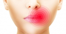 Stire din Sănătate : SUFERI DE HERPES? ÎN SFÂRȘIT, UN REMEDIU EFICIENT