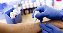 Stire din Sănătate : Alergia cu efect întârziat. Pericol pentru imunitate?