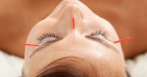 Stire din Sănătate : Spuneți "nu" răcelilor! Imunitatea crește prin acupunctură