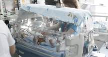 Stire din Sănătate : Medicii de la "Marie Curie", despre siamezele din Constanța: "Au două inimi unite. Șanse minime să trăiască"