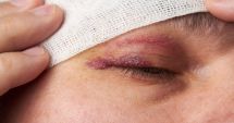 Stire din Actualitate : Opt copii au ajuns la spital după ce colegii lor de la internat le-au pus lipici în ochi în timp ce dormeau