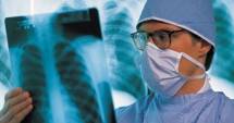 Stire din Sănătate : Investigații gratuite pentru diagnosticarea cancerului pulmonar