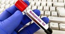 Stire din Social : OMS menține ALERTA la nivel mondial pentru variola maimuței. Peste 70.000 de infectări de la debutul epidemiei, în 6 luni