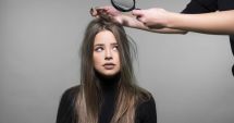 Stire din Sănătate : Mătreaţa nu reprezintă decât foarte rar un semnal de alarmă