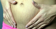 Stire din Sănătate : Metoda de refacere a abdomenului, indicată după naștere sau slăbit