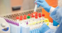 Noi reguli la testarea pentru detectarea noului coronavirus. Cine va putea face testul