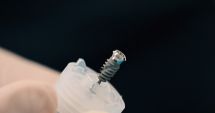 Stire din Sănătate : Servicii personalizate cu ajutorul tehnologiilor moderne. Cum reușește clinica Toldimed să aibă rezultate remarcabile
