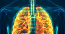 Stire din Actualitate : Studiu: Pacienții vindecați de Covid-19 rămân cu leziuni pulmonare după externare