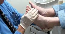 Stire din Sănătate : Podiatria, o nouă specializare medicală