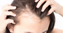 Care sunt factorii ce provoacă  boli ale scalpului