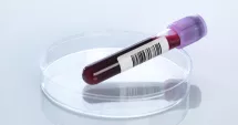 Stire din Sănătate : Sânge îngroșat? Ce opțiuni aveți pentru a preveni complicațiile periculoase