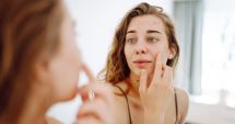 Stire din Sănătate : Cum faceţi diferența între dermatită seboreică și psoriazis