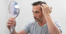 Stire din Sănătate : Migrenele și afecțiunile autoimune pot duce la un scalp sensibil