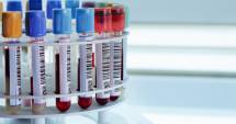 Stire din Sănătate : Se reiau testările gratuite pentru HIV și hepatită  în Spitalul Județean