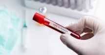 Stire din Social : COVID-19. 1.087 de cazuri noi, din doar 11.846 de teste. 25 de noi infectați, la Constanța