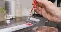 Stire din Sănătate : Testări gratuite pentru hepatita C