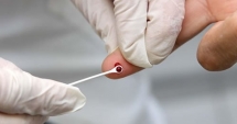 Stire din Sănătate : Până la 18 ani, testarea pentru HIV se face doar cu acordul părinților
