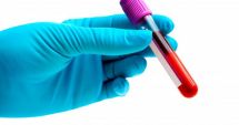 Stire din Actualitate : Preşedinte diagnosticat cu cancer de sânge! Boala, asimptomatică până la 60 de ani
