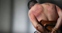 Stire din Social : Astăzi se sărbătoreşte Ziua internaţională pentru sprijinirea victimelor torturii