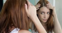 Stire din Sănătate : Foliculita poate provoca, uneori, umflături la nivelul scalpului