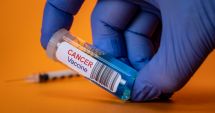 Stire din Actualitate : BioNTech și Regeneron avansează în dezvoltarea unui medicament pentru cancerul pulmonar