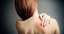 Stire din Sănătate : De ce apar vânătăile și ce explicație are specialistul