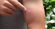 Stire din Sănătate : Încă două persoane au murit în urma infectării cu West Nile