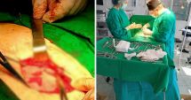 Stire din Social : Caz medical rar operat cu succes la Spitalul Orășenesc Hârșova