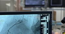 Stire din Social : Medicii constănțeni au implantat o sută de stenturi coronariene