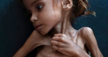 Stire din Actualitate : A MURIT fetița care a devenit simbolul crizei umanitare din Yemen