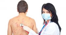 Stire din Sănătate : Zona Zoster, o boală care afectează toate vârstele