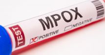 Stire din Actualitate : Marea Britanie anunţă primul caz de infectare cu noua variantă de mpox