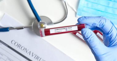 Tânăra preluată de medici de pe plaja Eforie Nord, confirmată cu coronavirus