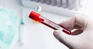 Patru angajate ale Direcției de Sănătate Constanța, infectate cu Covid-19