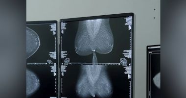 Stire din Social : Mamografii gratuite pentru depistarea cancerului la sân, la Năvodari